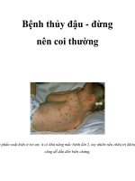 Bệnh thủy đậu - đừng nên coi thường pptx