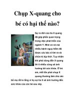 Chụp X-quang cho bé có hại thế nào? doc