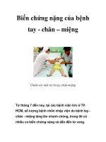 Biến chứng nặng của bệnh tay - chân – miệng doc