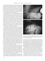 Improved Outcomes in Colon and Rectal Surgery part 7 pps
