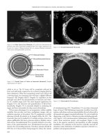Improved Outcomes in Colon and Rectal Surgery part 14 pptx
