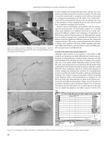 Improved Outcomes in Colon and Rectal Surgery part 11 docx