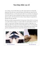 Xoa bóp chữa vẹo cổ pps