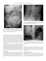 Improved Outcomes in Colon and Rectal Surgery part 12 ppsx