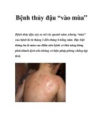 Bệnh thủy đậu “vào mùa” pps