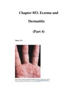 Chapter 053. Eczema and Dermatitis (Part 4) docx