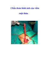 Chẩn đoán hình ảnh của viêm ruột thừa pdf