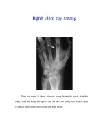 Bệnh viêm tủy xương pdf