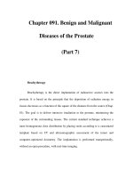 Chapter 091. Benign and Malignant Diseases of the Prostate (Part 7) potx