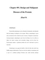 Chapter 091. Benign and Malignant Diseases of the Prostate (Part 9) pdf