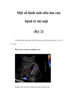 Một số hình ảnh siêu âm của bệnh lý túi mật (Kỳ 2) pps