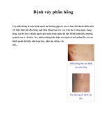 Bệnh vảy phấn hồng ppsx