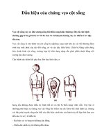 Dấu hiệu của chứng vẹo cột sống doc