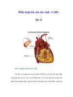 Phẫu thuật bắc cầu chủ vành - CABG (Kỳ 2) pptx