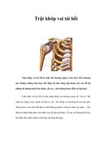 Trật khớp vai tái hồi doc