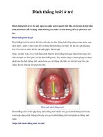 Dính thắng lưỡi ở trẻ pps