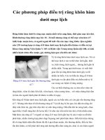 Các phương pháp điều trị răng khôn hàm dưới mọc lệch ppt