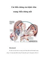 Các biến chứng của bệnh viêm xoang: biến chứng mắt potx