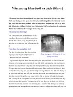 Vẩu xương hàm dưới và cách điều trị pps