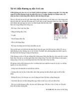 Xử trí chấn thương sọ não ở trẻ em pps