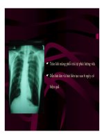 DẪN LƯU MÀNG PHỔI (PHẦN 5) ppsx