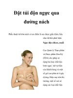 Đặt túi độn ngực qua đường nách pot