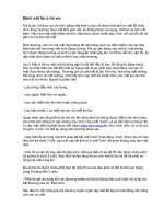 Bệnh mắt lác ở trẻ em pps