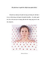 Sốt phát ban ở người lớn: Bệnh chưa phát đã lây! Sốt phát ban, thường là pot