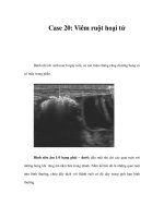 Case 20: Viêm ruột hoại tử ppt