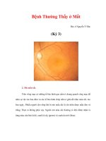 Bệnh Thường Thấy ở Mắt Bác sĩ Nguyễn Ý Đức (Kỳ 3) pptx