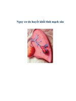 Nguy cơ do huyết khối tĩnh mạch sâu pdf