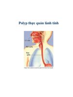 Polyp thực quản lành tính pps