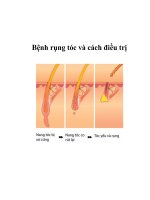 Bệnh rụng tóc và cách điều trị pdf