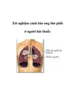 Xét nghiệm cảnh báo ung thư phổi ở người hút thuốc potx