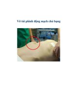 Vỡ túi phình động mạch chủ bụng pot