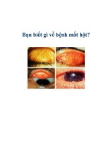 Bạn biết gì về bệnh mắt hột? pdf