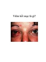 Viêm kết mạc là gì? ppsx