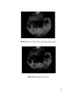 Giáo trình xử lý ảnh y tế Tập 2 P15 docx