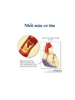 Nhồi máu cơ tim potx