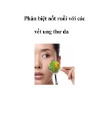 Phân biệt nốt ruồi với các vết ung thư da potx