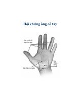 Hội chứng ống cổ tay ppt