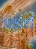 Hình ảnh một số vi sinh vật pot