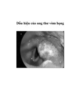 Dấu hiệu của ung thư vòm họng doc