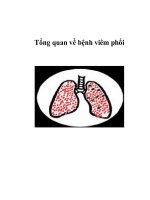 Tổng quan về bệnh viêm phổi docx