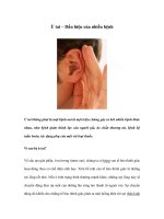 Ù tai – Dấu hiệu của nhiều bệnh potx