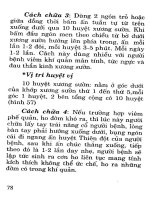 Đông Y - Bấm Huyệt Chữa Các Bệnh Thường Gặp phần 5 pptx
