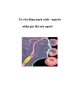 Xơ vữa động mạch cảnh - nguyên nhân gây liệt nửa người potx