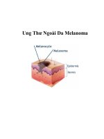 Ung Thư Ngoài Da Melanoma potx