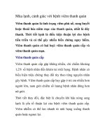 Mùa lạnh, cảnh giác với bệnh viêm thanh quản doc