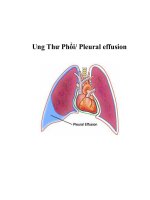 Ung Thư Phổi/ Pleural effusion ppt